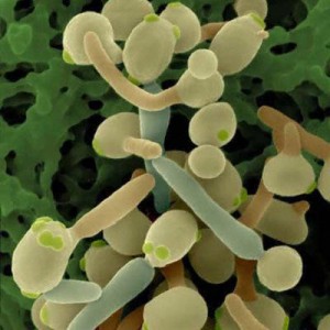 Дрожжевидный грибок Candida - причина молочницы