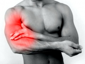 Боль в мышцах - одно из проявлений гиперпаратиреоидного криза