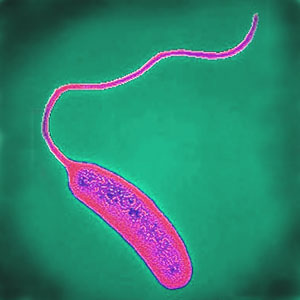 Холерный вибрион - возбудитель холеры