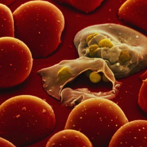 Плазмодии - возбудители малярии