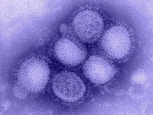 Вирус возбудитель свиного гриппа "Мичиган"