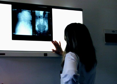 Расшифровка рентгена пищевода и желудка