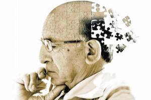 Болезнь Альцгеймера - прогрессирующее заболевание