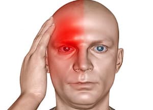 Приступ мигрени сопровождается болью в половине головы