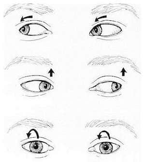 Нистагм глаз может быть вертикальный, горизонтальный или представлять движения по кругу