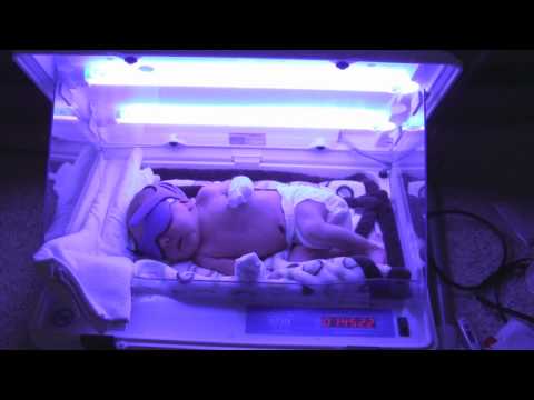 Фототерапия при желтухе новорожденных