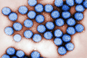 Ротавирус у детей - возбудитель под микроскопом