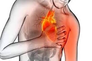 Стенокардия - давящая боль в сердце