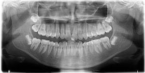 Диагностика аномалии зубов